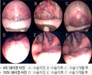 수술디자인