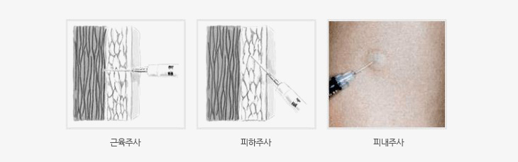 근육주사 , 피하주사, 피내주사